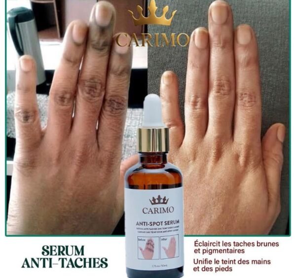 Sérum anti-tache – Image 2
